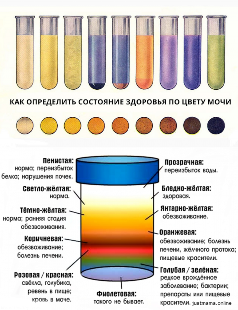 Мочеиспускание красного цвета. Какого цвета моча у грудничка в 2. Изменение цвета мочи. Нормальный цвет мочи. Мутная моча.