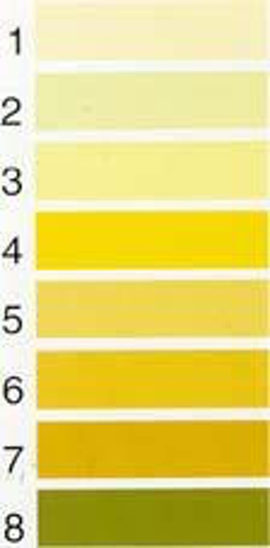Желтый цвет мочи. Темно соломенный цвет мочи. Ярко желтый цвет мочи. Цвет мочи обезвоживание. Диаграмма цвета мочи.