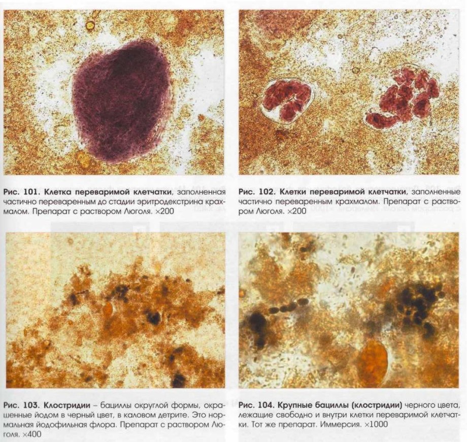 Микроскопия кала переваримая клетчатка