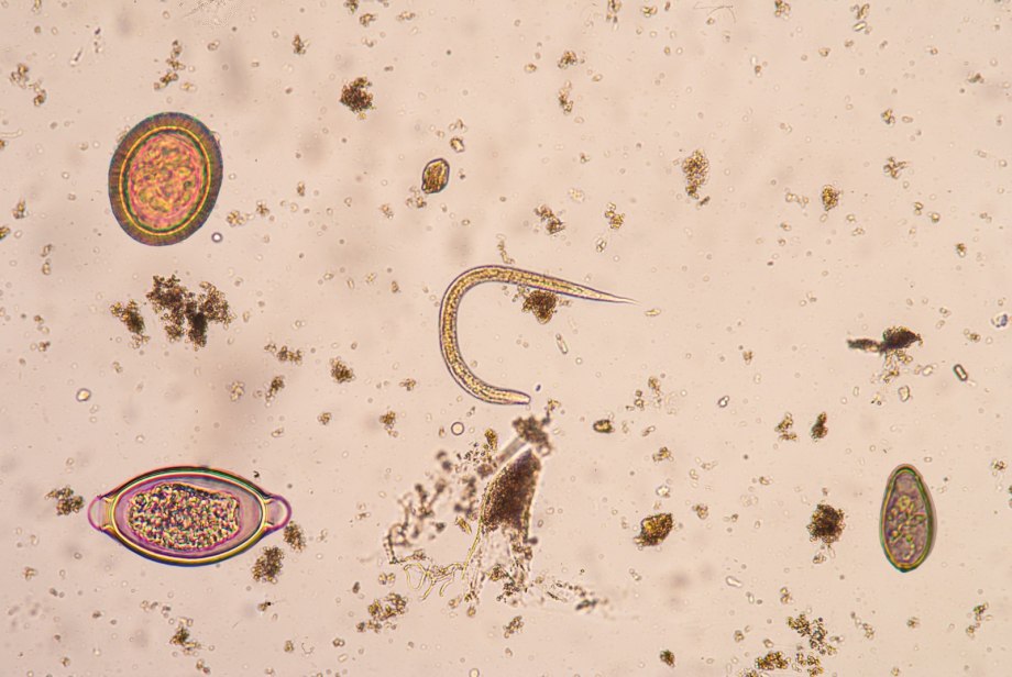 Железница угревая Demodex folliculorum