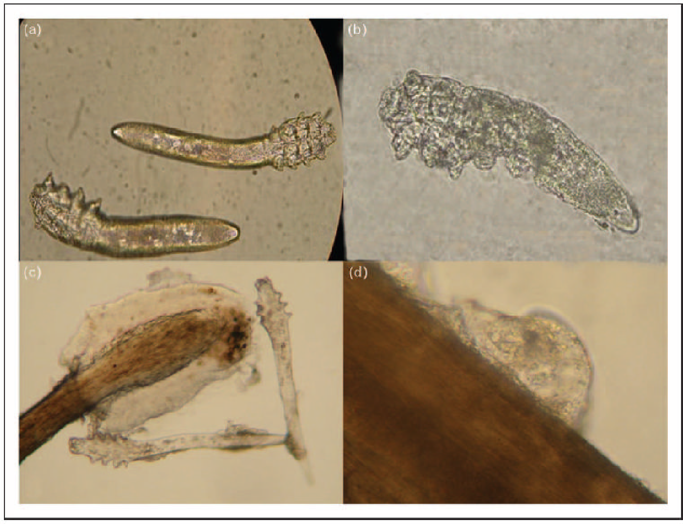 Эффективное лечение демодекса. Железница угревая Demodex folliculorum. Клещ демодекс фолликулорум. Железница угревая - клещ паразитология. Demodex folliculorum заболевание.