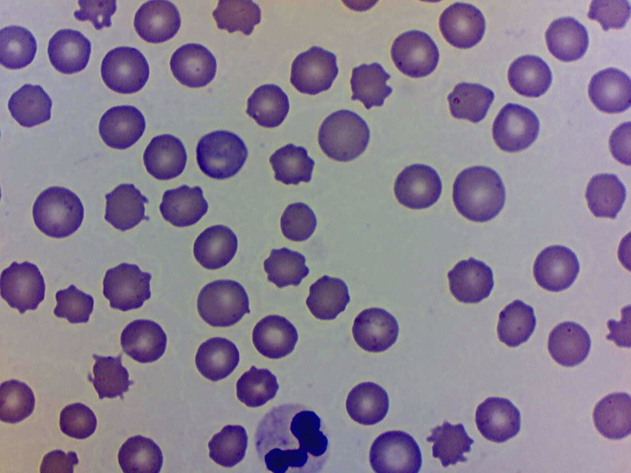 Повышенные лейкоциты в крови собаки