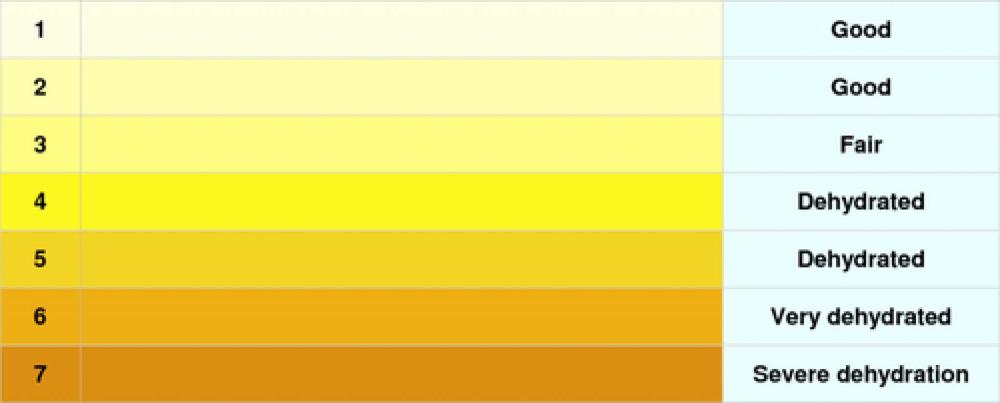 Ярко желтая моча. Шкала цвета мочи. Насыщенный желтый цвет мочи. Оттенки желтого цвета.