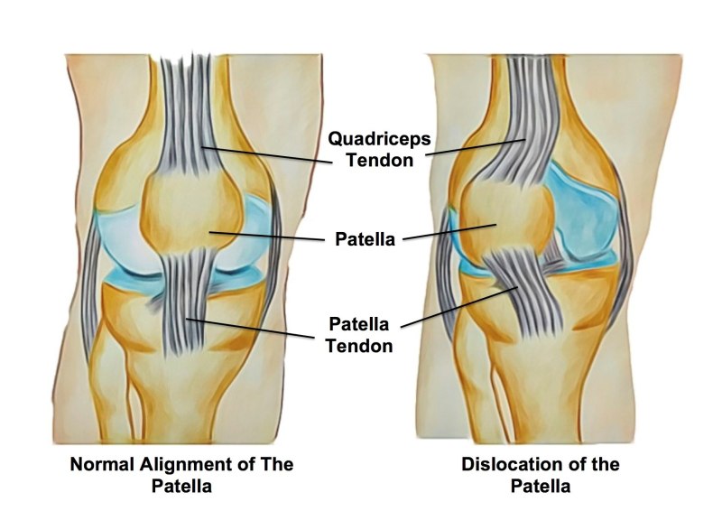 Patella анатомия