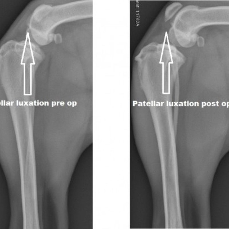 Lig Patellae
