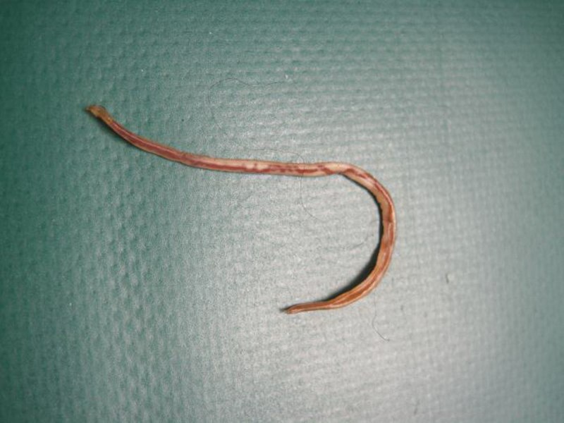 Круглый гельминт Ascaris lumbricoides