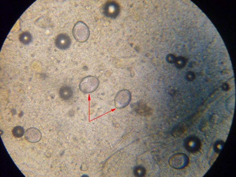 Trichuris Vulpis