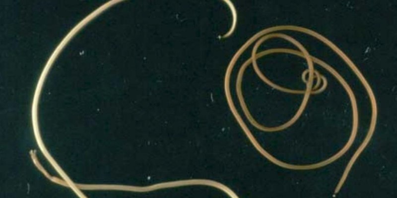 Ascaris lumbricoides заболевание